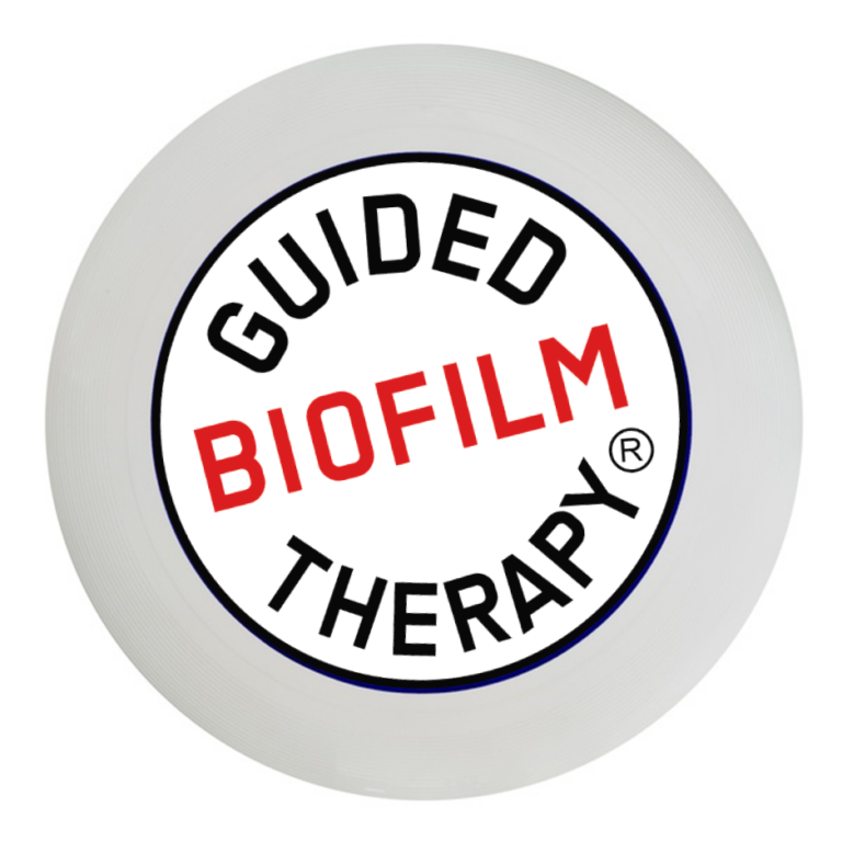 GBT Frisbee